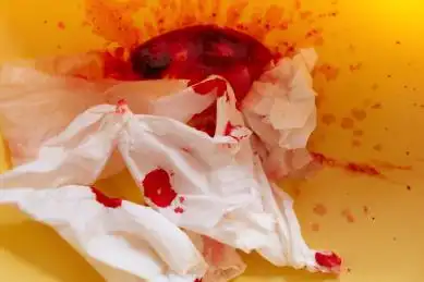 有血迹的白纸巾 红色