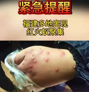 至我国435个县市区紧急提醒福建多地红蚂蚁聚集厦门有人被咬直接休克