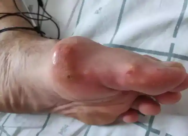 母亲节|关爱女性痛风,给母亲一份最好的节日礼物!