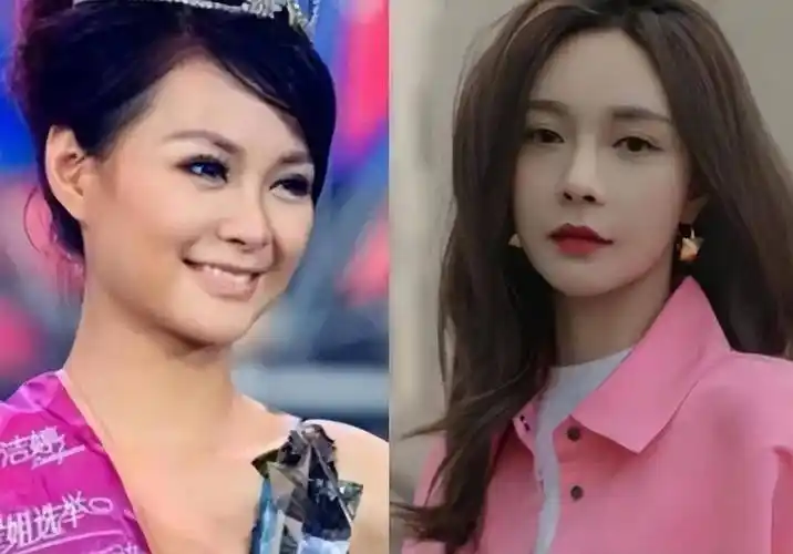 整容脸上镜多夸张?看完后,明白自然美有多重要了_沈梦辰_因为_五官