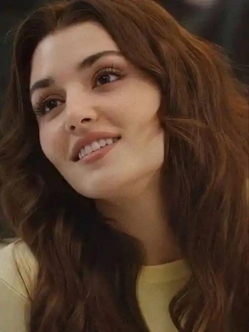 土耳其女明星"发量爆棚"秘籍!植发界top品牌!洗完头发疯长!