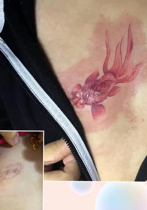 手术疤痕遮盖纹身图片