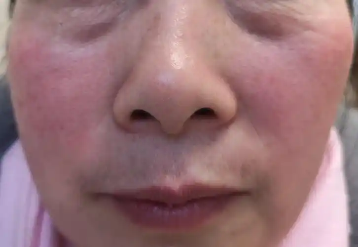 脸儿为什么这样红