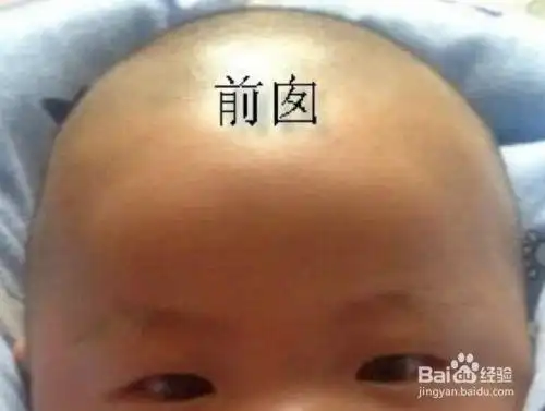 新生儿卤门要如何护理?