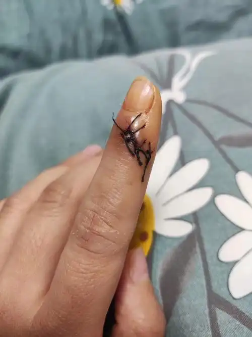 切菜切到手该怎么办? - 知乎