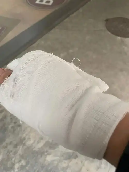 昨日收盘后去了医院,右手被医院夸张地包扎成猪脚一样,所以昨日没写