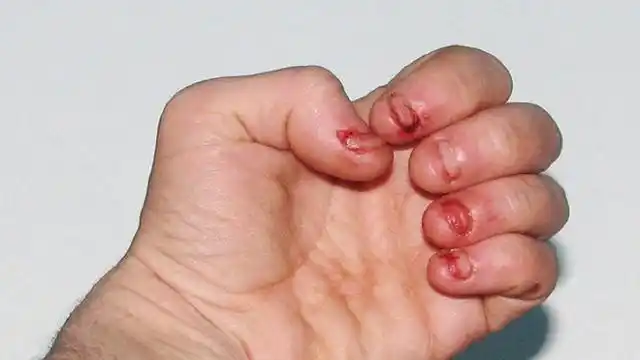 孩子咬手指,抠鼻孔,打脑袋,是疾病的预兆?作为家长要了解