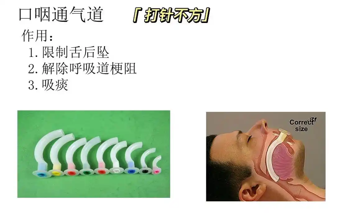 口咽通气道总结.#图文伙伴计划 #护士懂护士 #护士 #实习 - 抖音