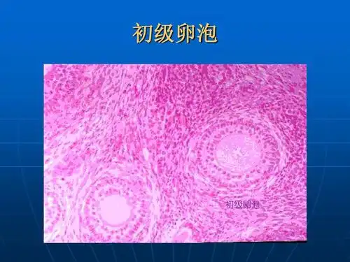 初级卵泡