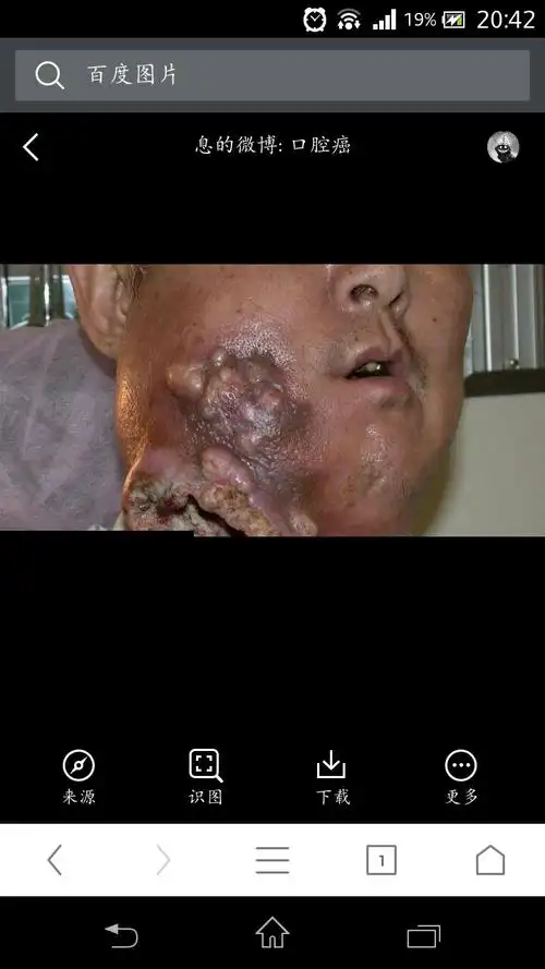 危害2:槟榔会造成习惯性成瘾