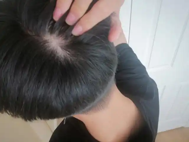 而在民间,关于头发旋的传说很多.头上两个旋的女孩是