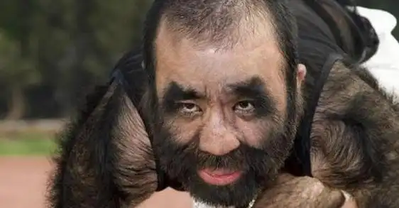 中国毛孩,出生时全身就长满了体毛,随着年龄的增长,体毛也越来越. .