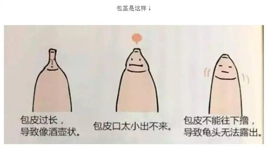 斜视手术学平险报销吗 包茎手术学平险人寿