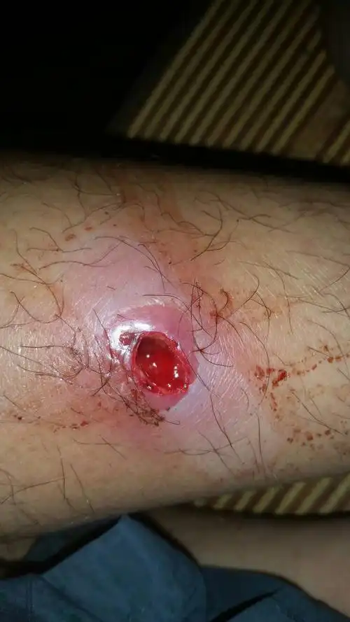 有一天挤出一点浓,后面口大了点慢慢的每过一段