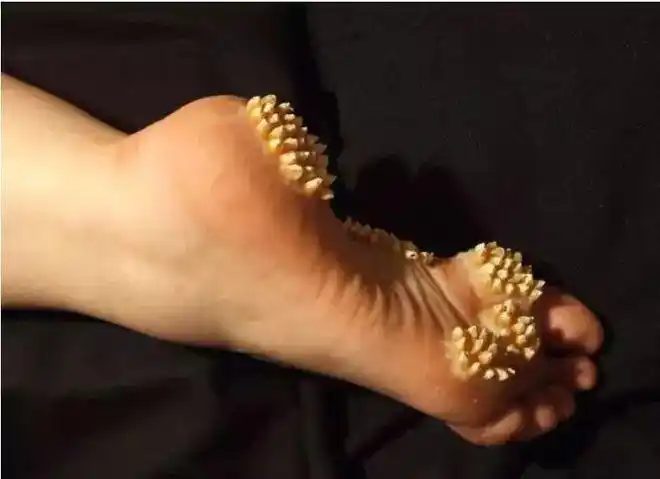 来,测试你你有没有密集恐惧症_网易订阅