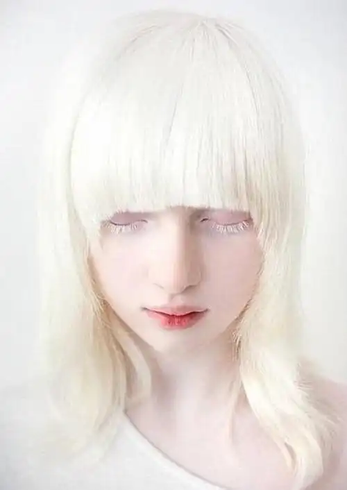 乌克兰女孩患罕见白化病全身雪白,从小遭人嘲笑,如今成模特!