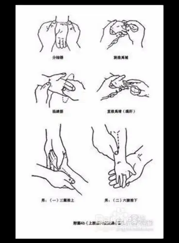 【解读】腱鞘炎的病因,治疗方案,预防措施