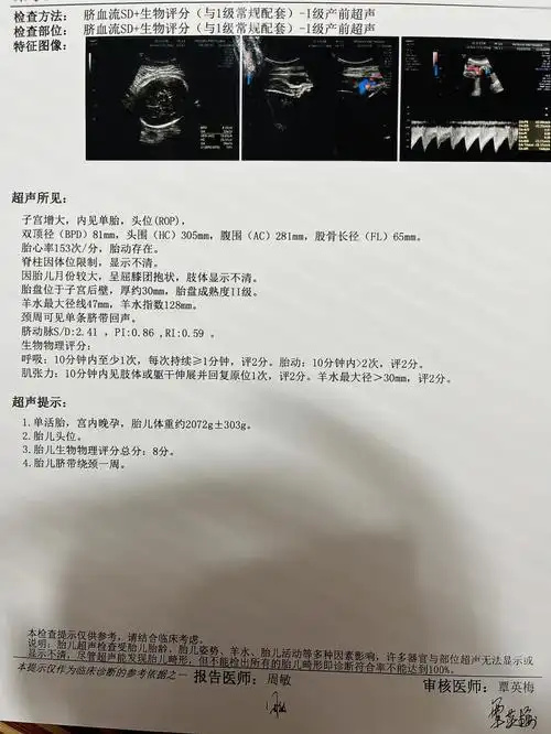 绕颈一周孕晚期后的第一次超声34周