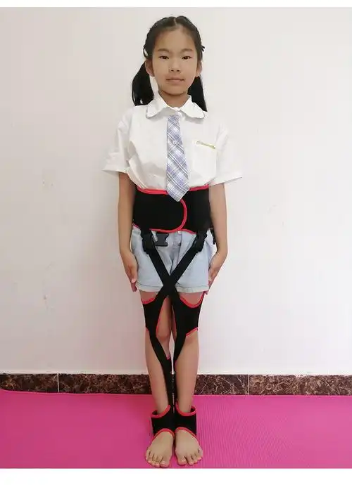 腿型器儿童宝宝婴儿o型腿器纠正腿型绑腿带x型腿xo腿带 (夜用家用)l码