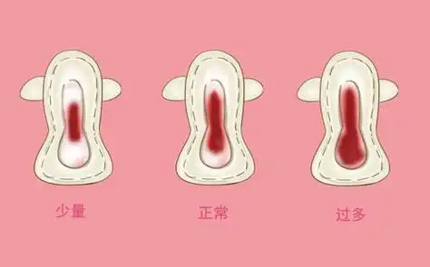 月经怎么才算是正常?_佛山都市妇产医院