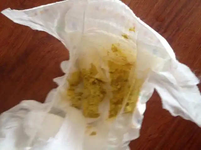 宝宝便便的问题