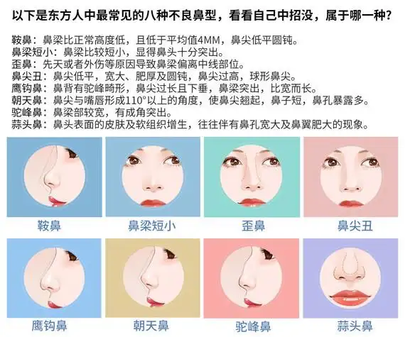 这一切都是因为他们的鼻子存在缺陷,都说"面如一枝花,全靠鼻当家"