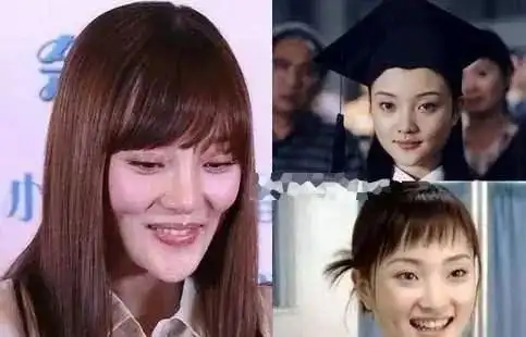 影后边网红 李小璐的整容之路