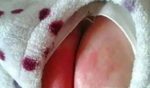 宝宝成长过程中容易出现的一些问题如何应对