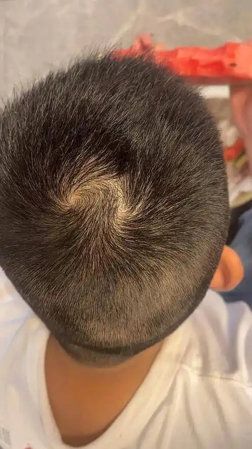 头顶"两个旋",代表着什么?很多人都理解错了!科学的解释来了