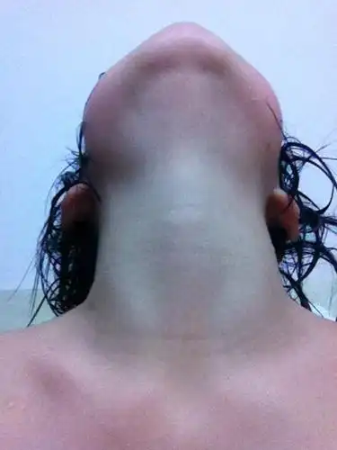 14岁,男生,喉结长这样可以吗