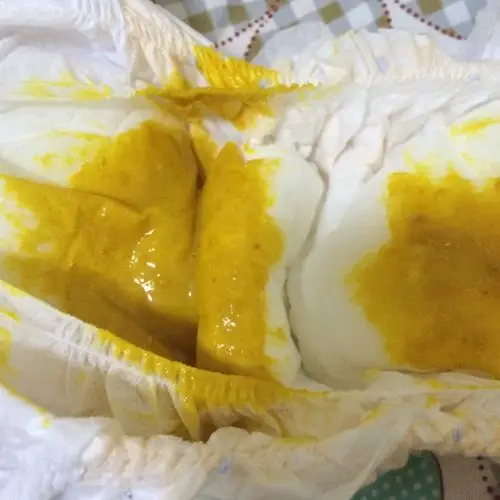 宝宝拉的粑粑是这样的,大家看看正常吗,母乳喂养的