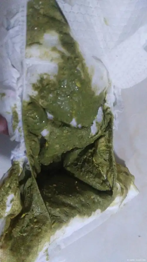 医生你好宝宝最近几天拉的绿色屎不知道是为什么有图帮忙一下