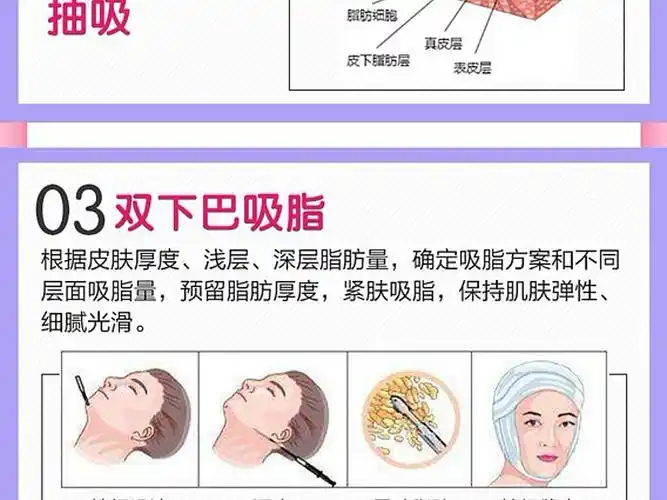 洗净,每天多次重复执行,直到双下巴消失2为了改善与肥胖有关的双下巴