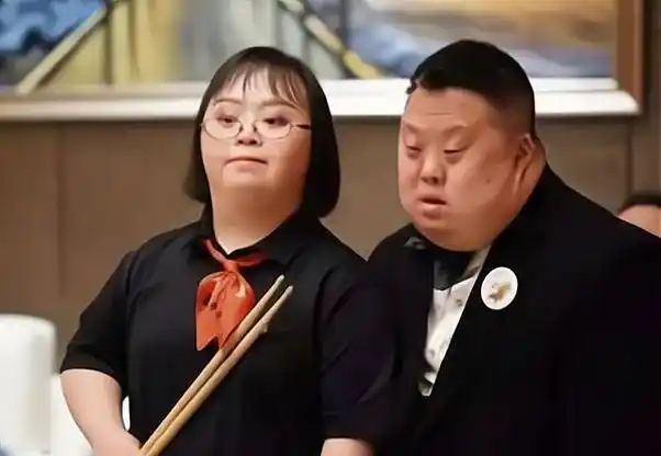 为何患有唐氏综合征的孩子长相都差不多看完你就明白了