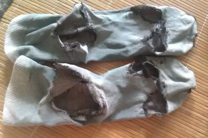 那会儿,男孩用剪刀把白天刚学会的剪纸"手艺"用在了正穿着的袜子上