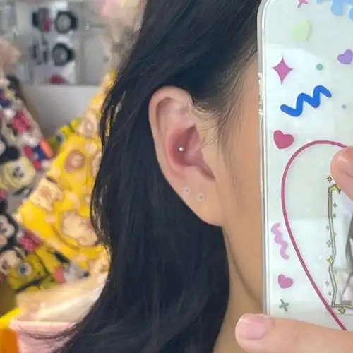 耳蜗钉到底疼不疼75