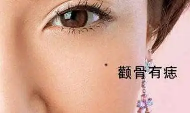 左脸颧骨长痣的女人命运好不好