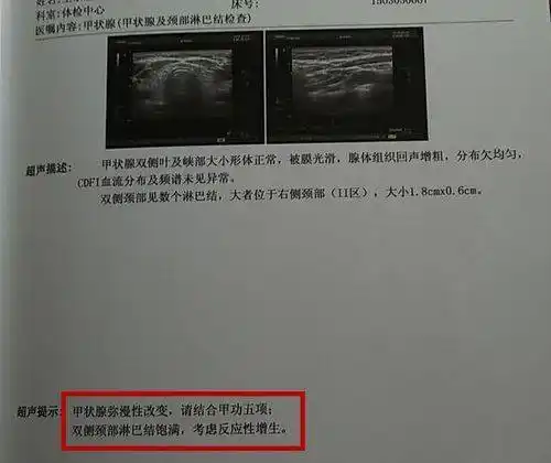 辅心堂中医甲状腺结节纵横比怎么看是什么意思