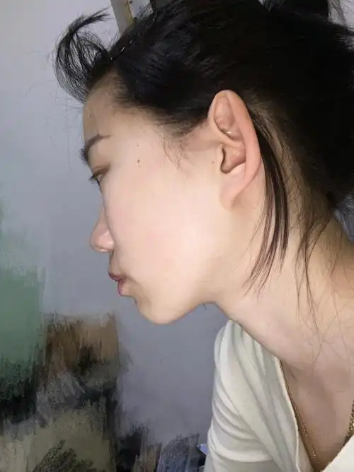 脸平的原因06是鼻子太低还是嘴凸啊