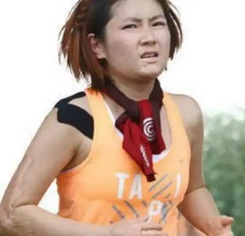 图selina烧伤后的腿照片曝光前夫坦言第一次看到想吐