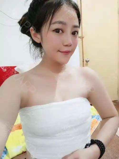 自体脂肪丰胸真人分享,值得一做