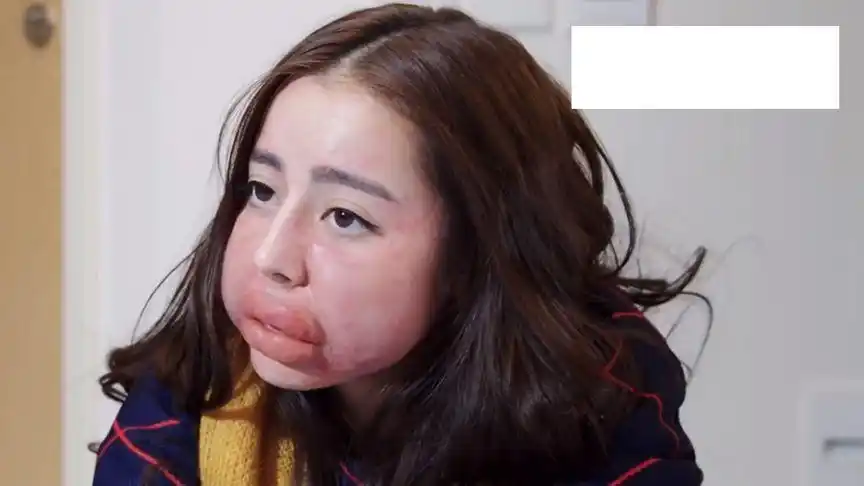 傲慢与偏见(2):迪丽热巴花粉过敏,脸肿了,太丑了