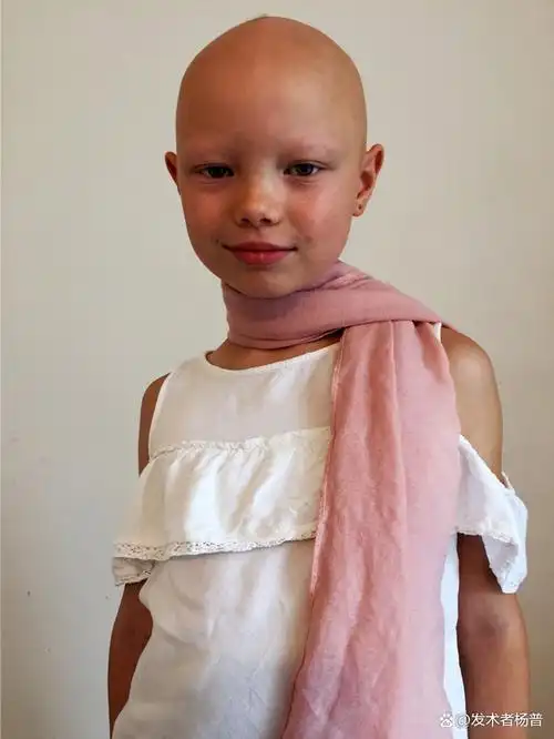 8岁脱发小女孩成为模特她从未失去信心