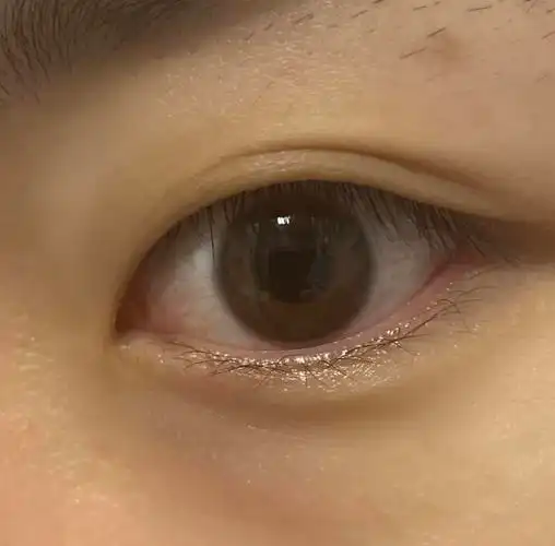 没戴的 才发现我本身瞳孔外边也有一圈环戴了的 肉眼看除了大点几乎