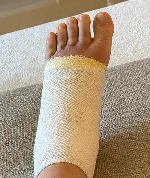 庾澄庆:不仅缺席2020中国好声音,连跑步都扭伤了脚只能拄双拐!