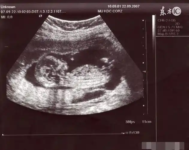 怀孕后期生男孩的症状,生过的宝妈都说准