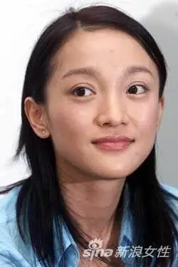 女子双眼皮埋线大变样欧式大双已经out了现在流行的是超自然款