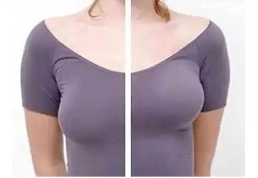 万物皆上涨,唯有胸下垂,怎么办?