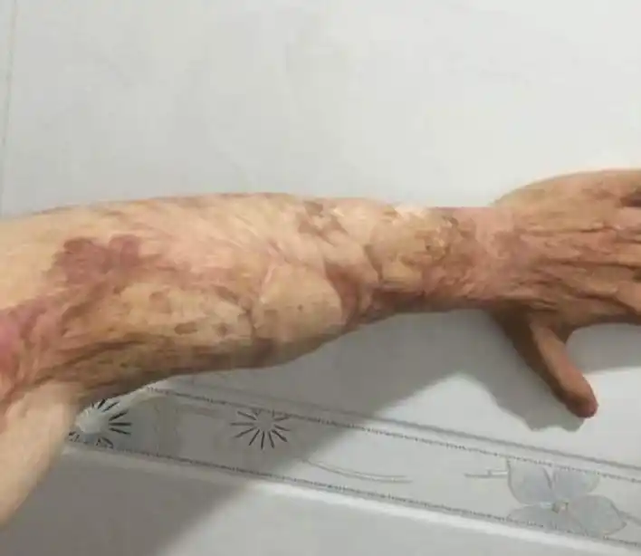 似乎怎么都说不通,医生越看越惊,假装镇定地问道:" 您手臂上的伤口