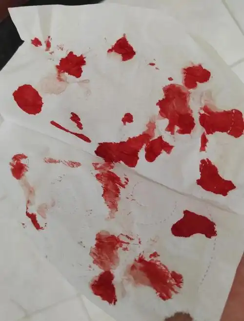 北京新冠感染症状全过程